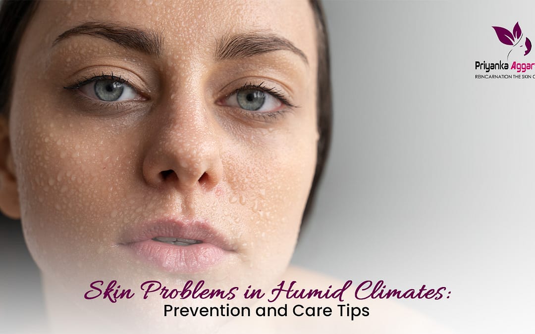 Skin Problems in Humid Climates: Your Guide to Happy, Healthy Skin!