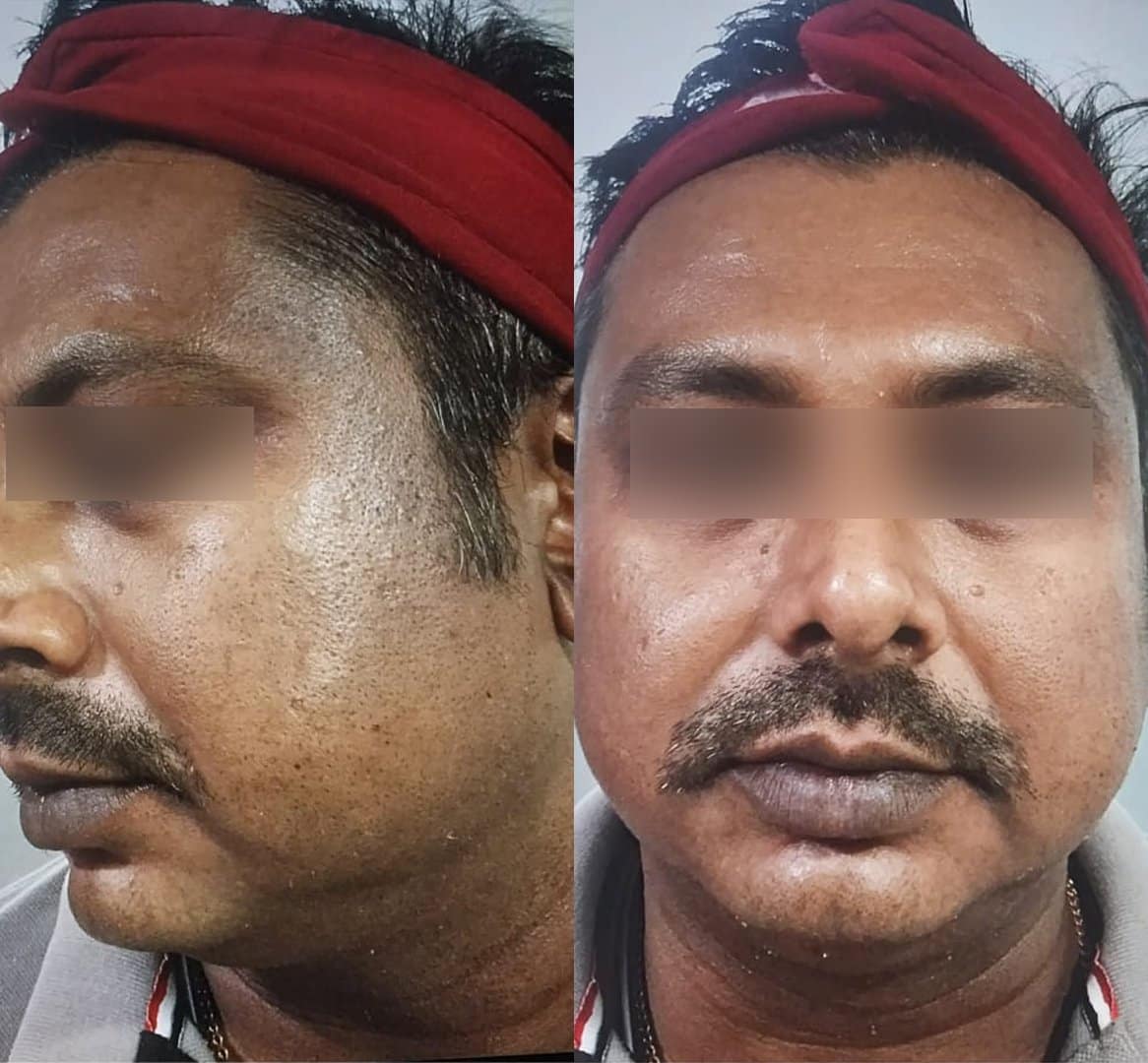 Dermatologist in Kolkata