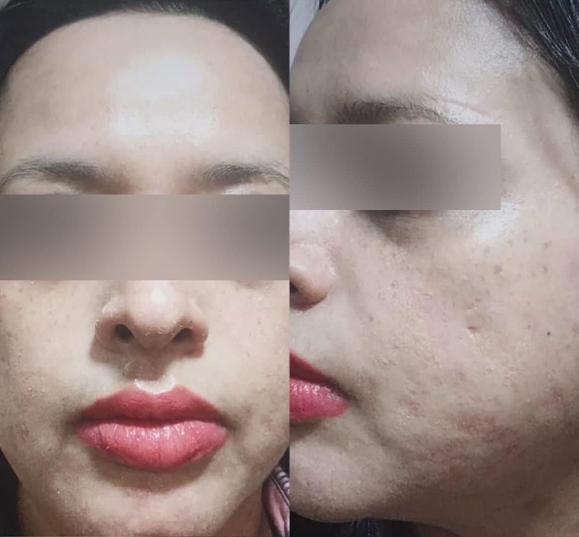 Dermatologist in Kolkata