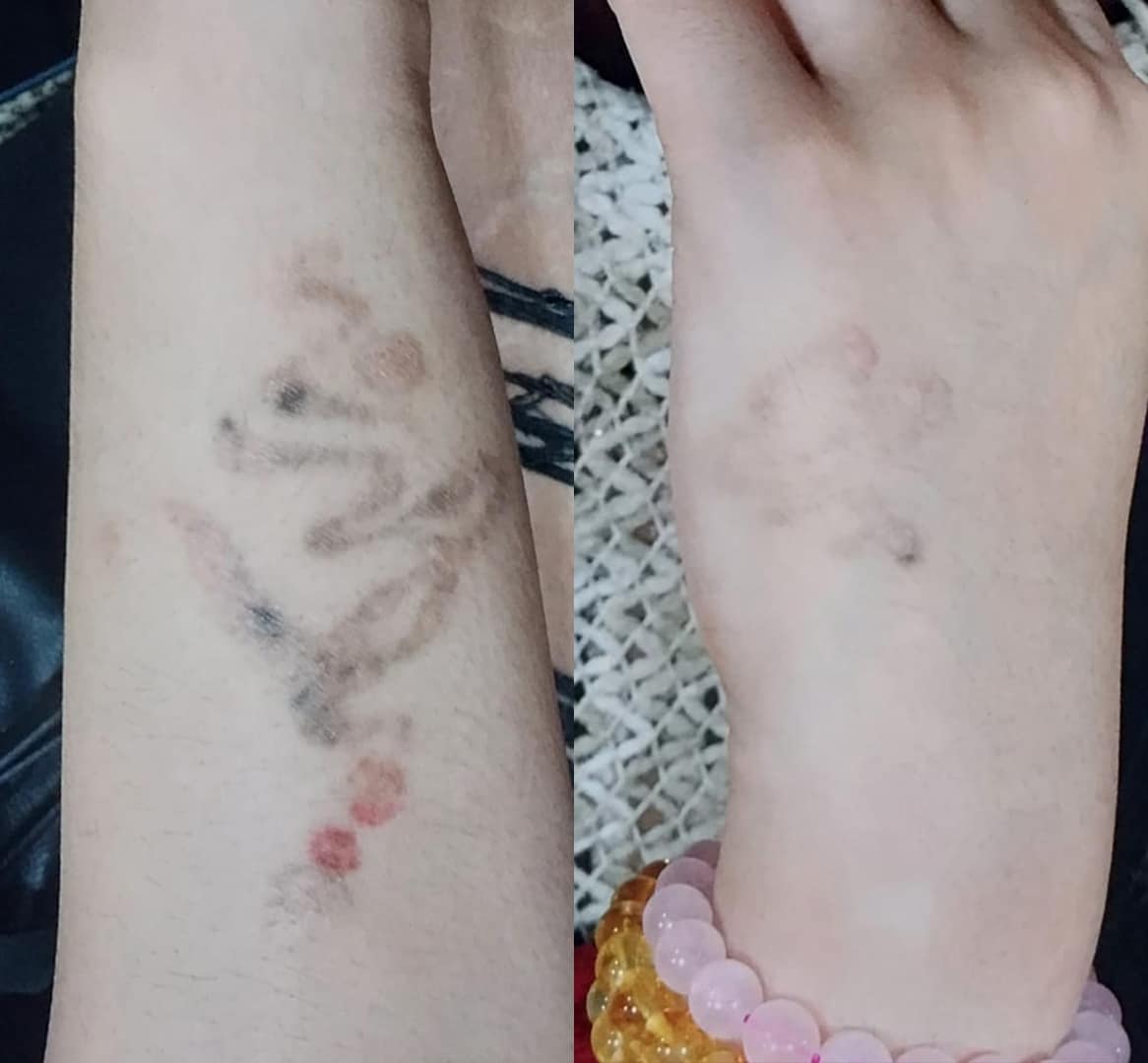 Dermatologist in Kolkata