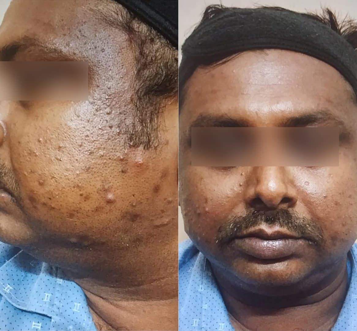 Dermatologist in Kolkata