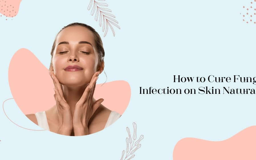 how to cure fungal infection on the skin naturally