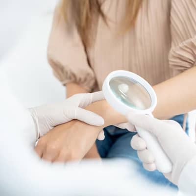 Manage Vitiligo
