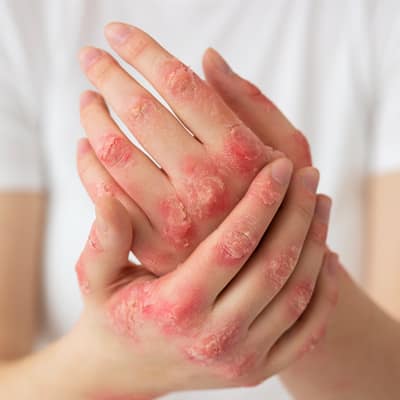 Unusual skin patches